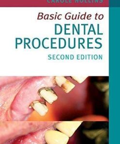 Basic Guide To Dental Procedures 2Nd Edition