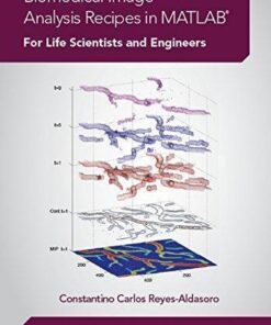 Biomedical Image Analysis Recipes In Matlab For Life Scientists And Engineers
