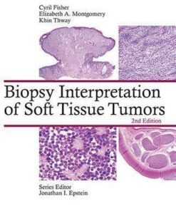 Biopsy Interpretation Of Soft Tissue Tumors 2Nd Edition