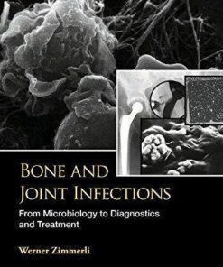 Bone And Joint Infections From Microbiology To Diagnostics And Treatment