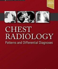 Chest Radiology Patterns And Differential Diagnoses 7Th Edition