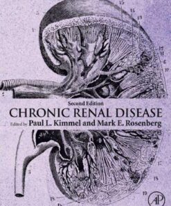 Chronic Renal Disease 2Nd Edition