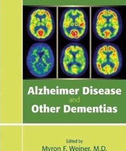 Clinical Manual Of Alzheimer Disease And Other Dementias