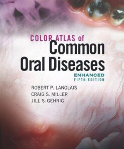 Color Atlas Of Common Oral Diseases Enhanced 5Th Edition