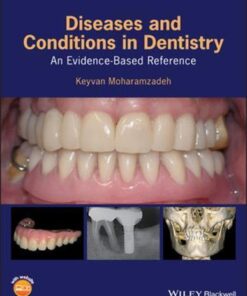 Diseases And Conditions In Dentistry An Evidence Based Reference