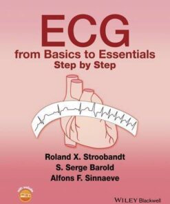 Ecg From Basics To Essentials Step