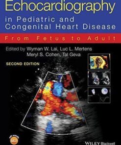 Echocardiography In Pediatric And Congenital Heart Disease From Fetus To Adult 2Nd Edition