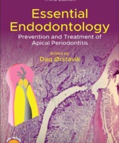 Essential Endodontology Prevention And Treatment Of Apical Periodontitis 3Rd Edition