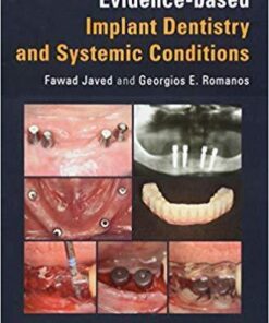 Evidence Based Implant Dentistry And Systemic Conditions