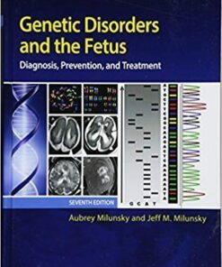 Genetic Disorders And The Fetus Diagnosis Prevention And Treatment 7Th Edition