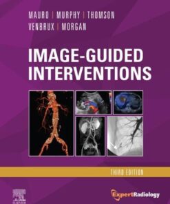 Image Guided Interventions Expert Radiology Series 3Rd Edition