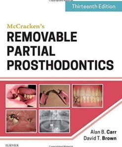 Mccrackens Removable Partial Prosthodontics 13Th Edition