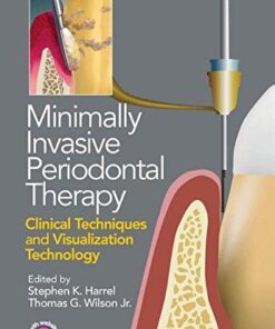 Minimally Invasive Periodontal Therapy Clinical Techniques And Visualization Technology
