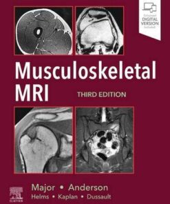 Musculoskeletal Mri 3Rd Edition