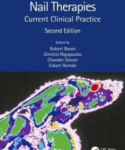Nail Therapies Current Clinical Practice 2Nd Edition