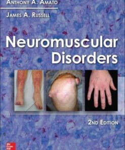 Neuromuscular Disorders 2Nd Edition Amato