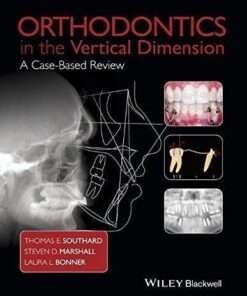 Orthodontics In The Vertical Dimension A Case Based Review
