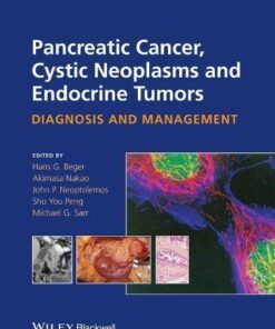 Pancreatic Cancer Cystic Neoplasms And Endocrine Tumors Diagnosis And Management