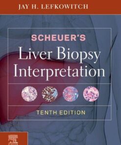 Scheuers Liver Biopsy Interpretation 10Th Edition