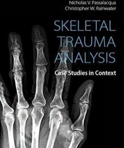 Skeletal Trauma Analysis Case Studies In Context