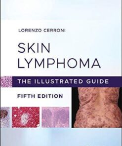 Skin Lymphoma The Illustrated Guide 5Th Edition