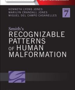 Smiths Recognizable Patterns Of Human Malformation 7Th Edition