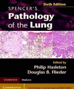 Spencers Pathology Of The Lung 6Th Edition